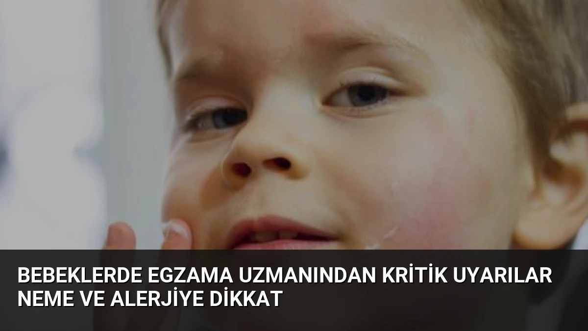 Bebeklerde Egzama Uzmanından Kritik Uyarılar Neme ve Alerjiye Dikkat