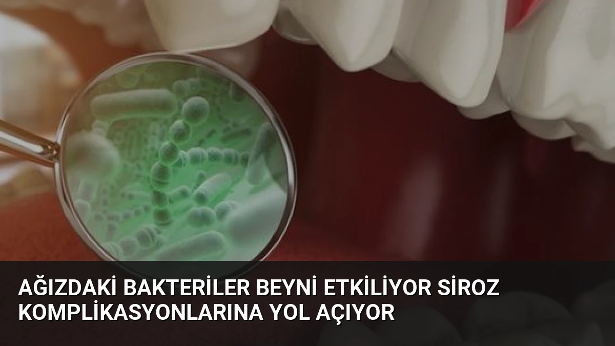 Ağızdaki Bakteriler Beyni Etkiliyor Siroz Komplikasyonlarına Yol Açıyor
