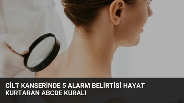 Cilt Kanserinde 5 Alarm Belirtisi Hayat Kurtaran ABCDE Kuralı